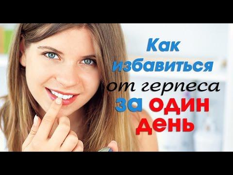 КАК ИЗБАВИТЬСЯ ОТ ГЕРПЕСА ЗА ОДИН ДЕНЬ